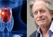 Michael Douglas’ HPV-relaterte halskreft: Det tidlige symptomet han ignorerte
